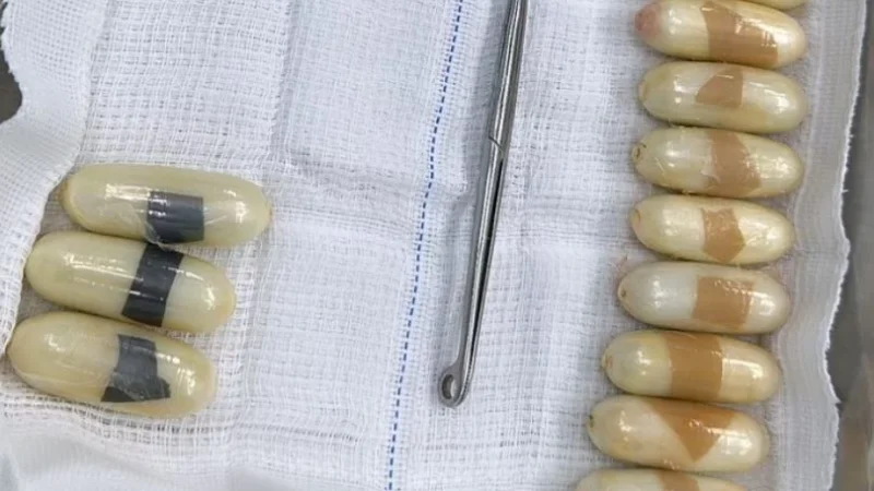 Mulher engole mais de 50 cápsulas de cocaína e é levada para hospital em Manaus