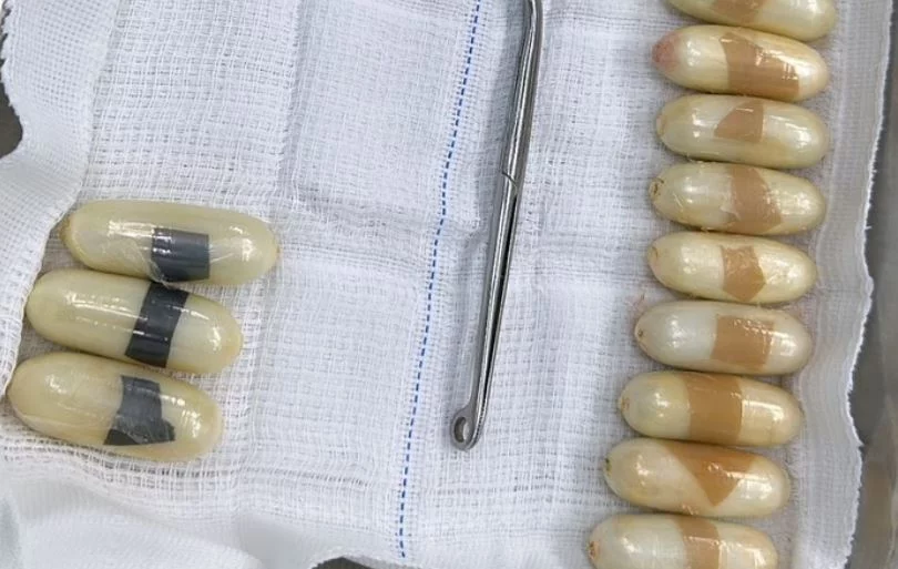Mulher engole mais de 50 cápsulas de cocaína e é levada para hospital em Manaus