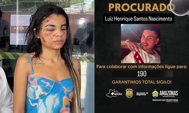 Homem que espancou e desfigurou mulher em Manaus se torna procurado da polícia