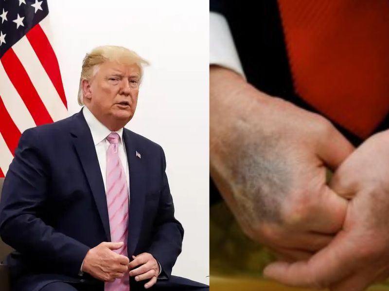 Suposta morte de Donald Trump gera especulações e memes no X