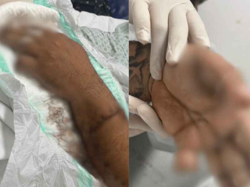 Motorista de app perde dedo após ser atacado por passageiro com terçado em Manaus