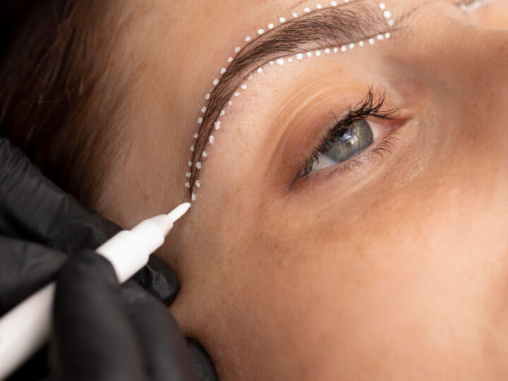 O que é Transplante de Sobrancelha e Quando ele é Indicado