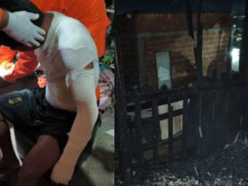 Vazamento em botija de gás provoca incêndio e deixa homem com corpo queimado, em Manaus